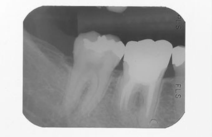 歯科用X線撮影装置