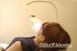歯科医院内で処置する「オフィスホワイトニング」