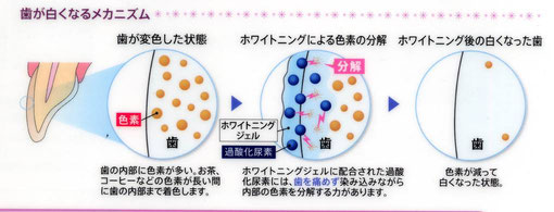 市販の歯磨き粉で行なうセルフホワイトニングとの違い